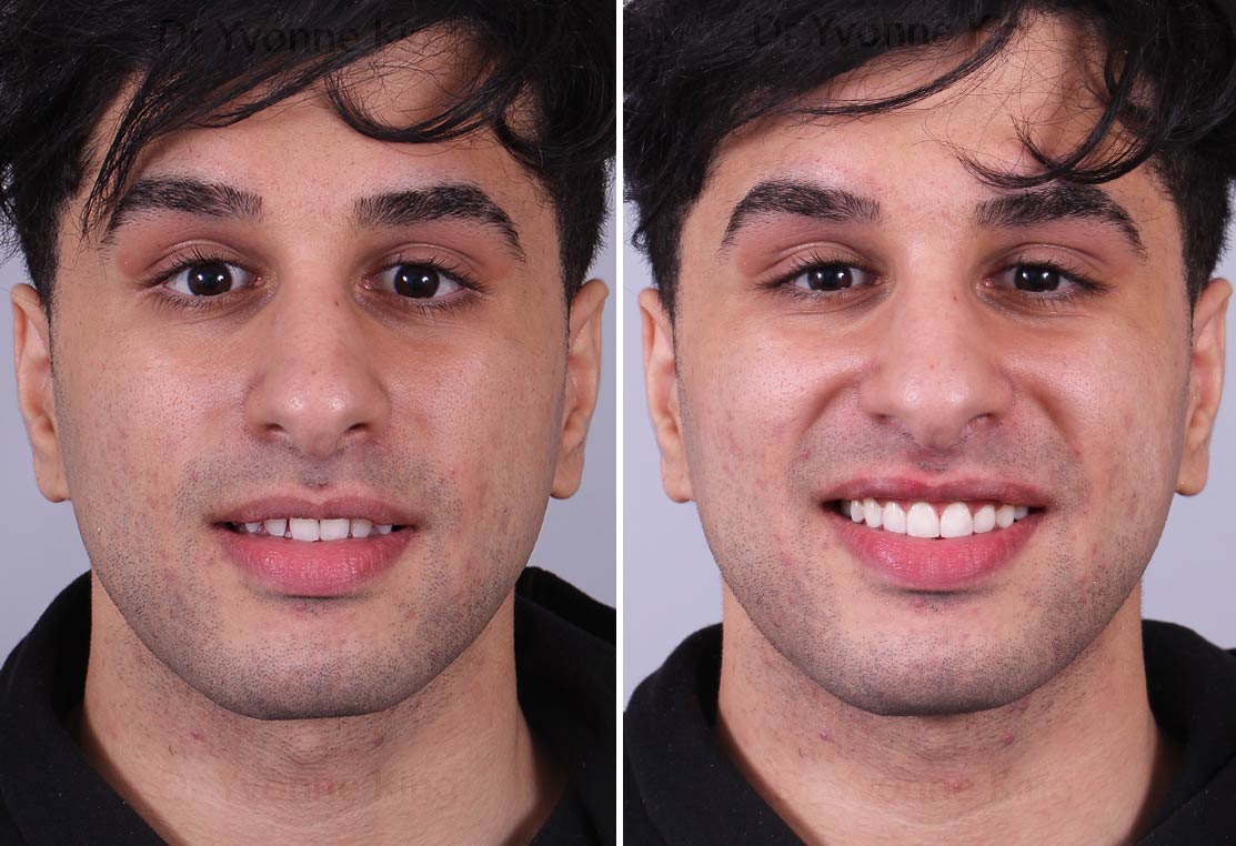 Before & After Smile Gallery CLDC Before & After Smile Gallery CLDC